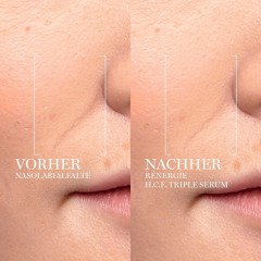 Lancome Renergie H.C.F. Triple Serum Тройная сыворотка антивозрастная 50мл